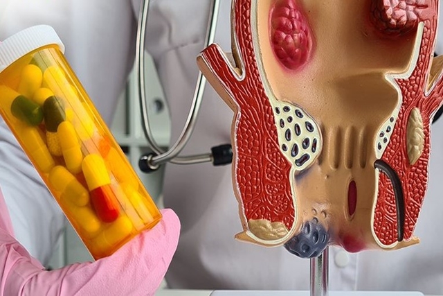 Câu hỏi thường gặp liên quan đến hẹp hậu môn ở trẻ em